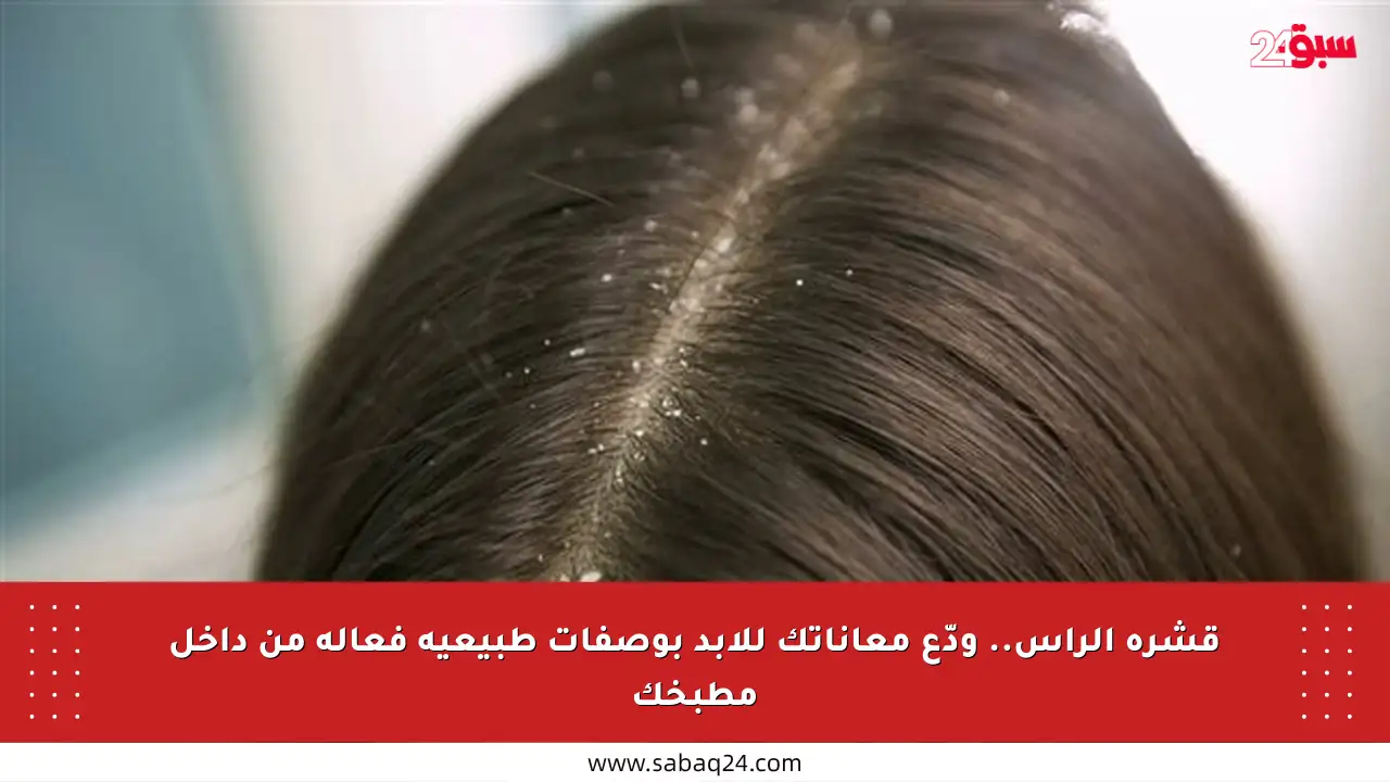 قشرة الرأس.. ودّع معاناتك للأبد بوصفات طبيعية فعالة من داخل مطبخك